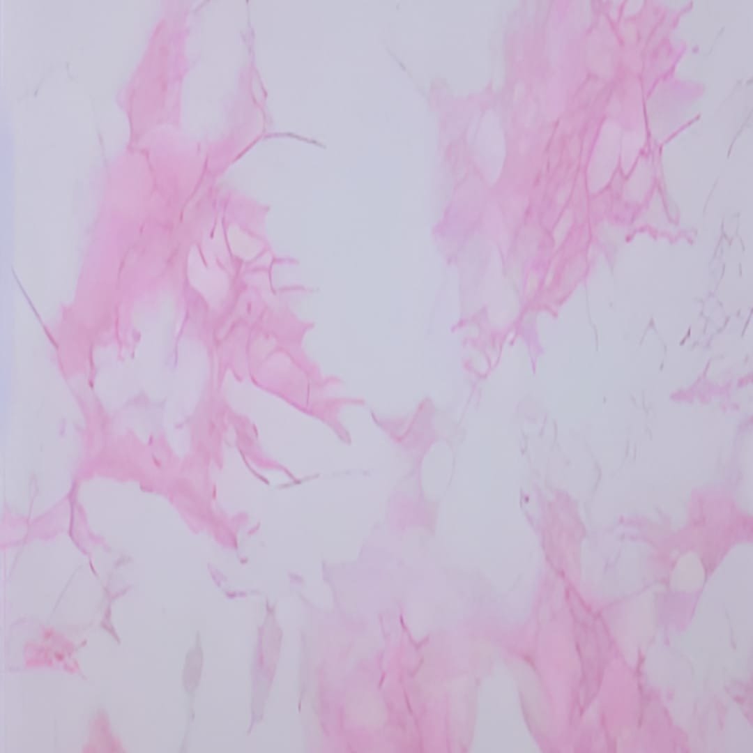 Revestimiento Interior PVC Fulltech Blanco Rosado Decorativo